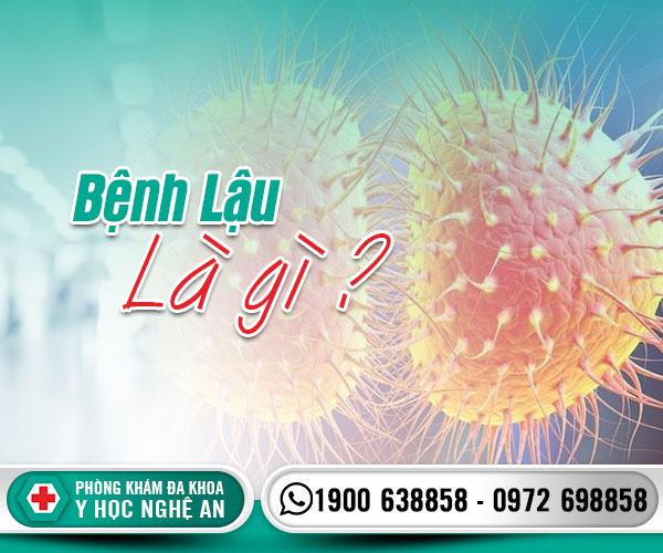 Bệnh lậu là gì