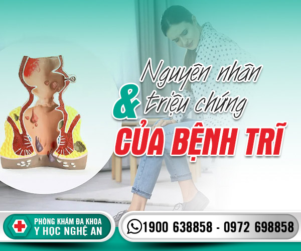 Nguyên nhân và triệu chứng của bệnh trĩ