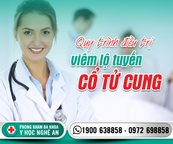 Quy trình điều tị viêm lộ tuyến cổ tử cung