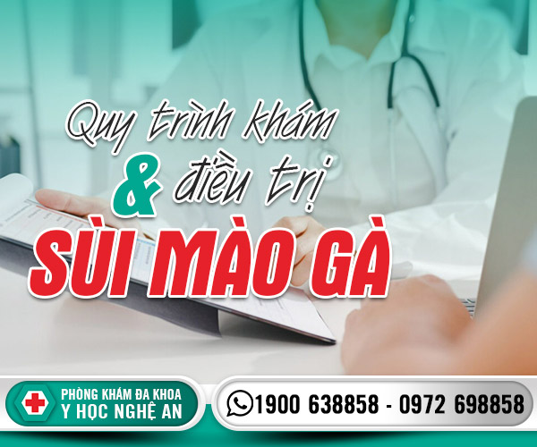 Quy trình khám và điều trị sùi mào gà