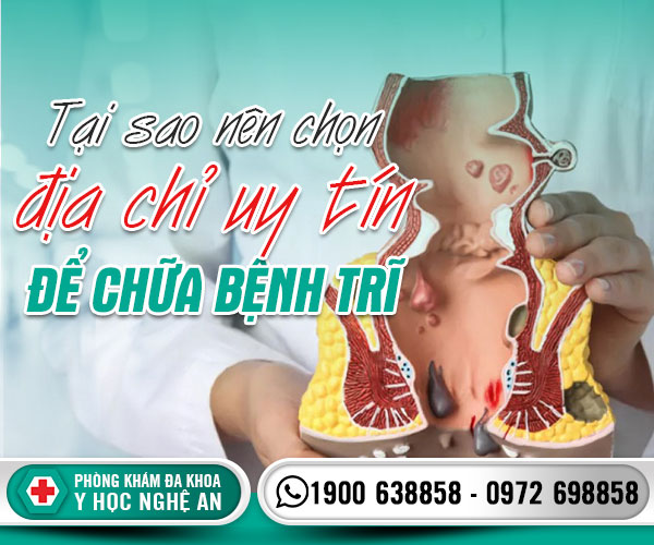 Tại sao nên chọn địa chỉ uy tín đẻ chữa bệnh trĩ
