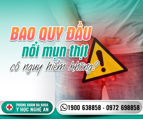Bao quy đầu nổi mụn thịt có nguy hiểm không