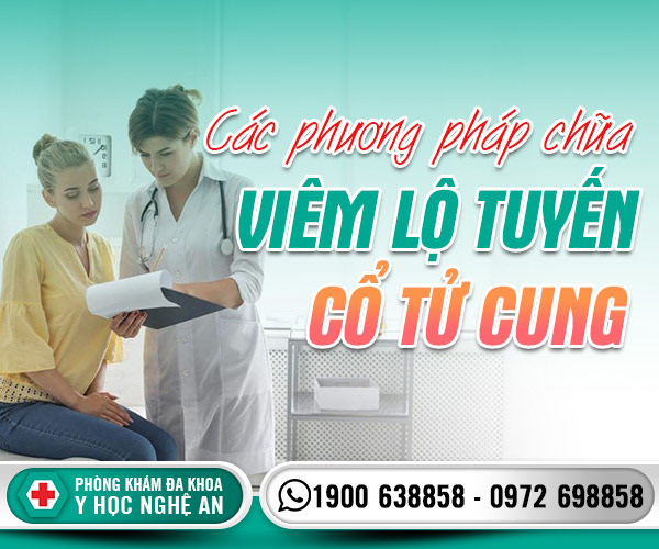 Các phương pháp chữa viêm lộ tuyến cổ tử cung