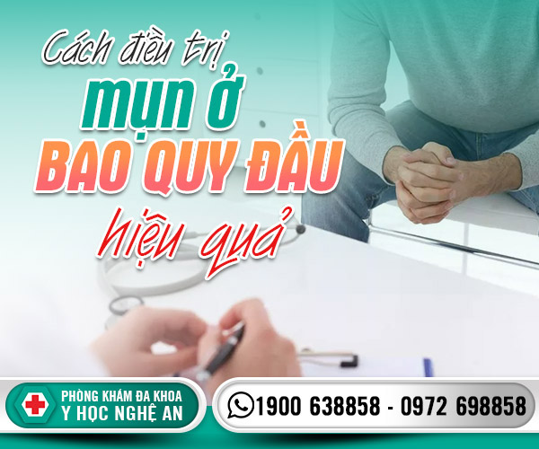 Cách điều trị mụn ở bao quy đầu