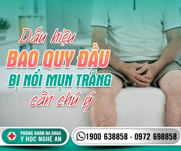 Dấu hiệu bao quy đầu bị nổi mụn trắng