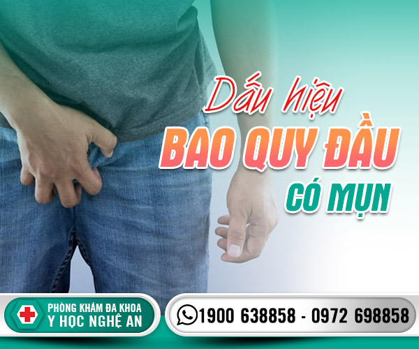 Dấu hiệu bao quy đầu có mụn