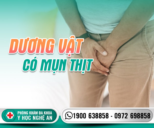 Dương vật có mụn thịt