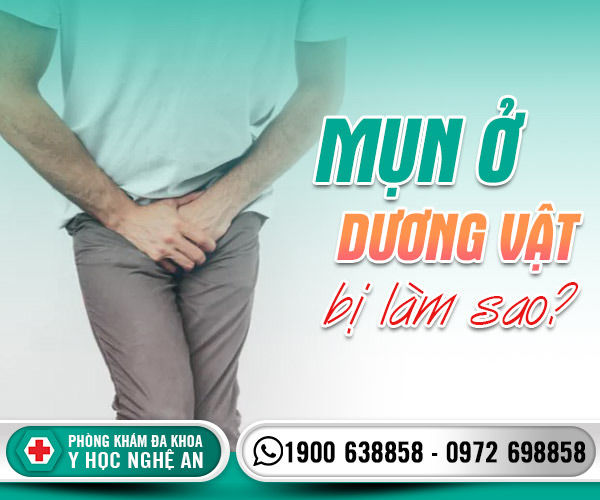 Mụn ở dương vật bị làm sao