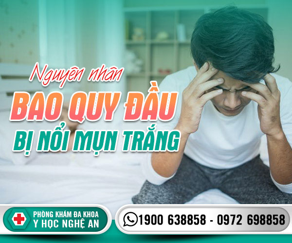 Nguyên nhân bao quy đầu bị nổi mụn trắng