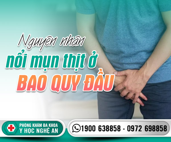 Nguyên nhân nổi mụn thịt ở bao quy đầu
