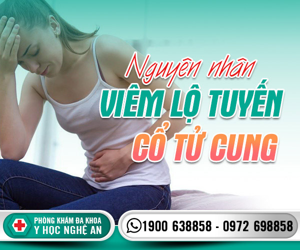 Nguyên nhân viêm lộ tuyến cổ tử cung