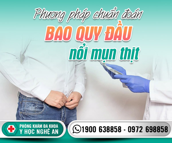 Phương pháp chuẩn đoán bao quy đầu nổi mụn thịt
