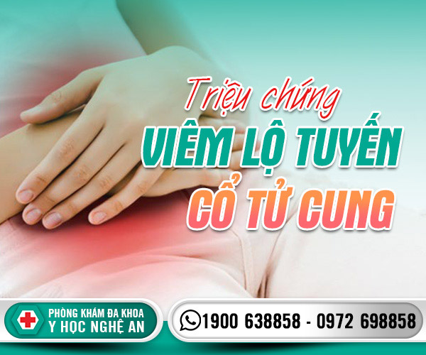 Các triệu chứng viêm lộ tuyến cổ tử cung