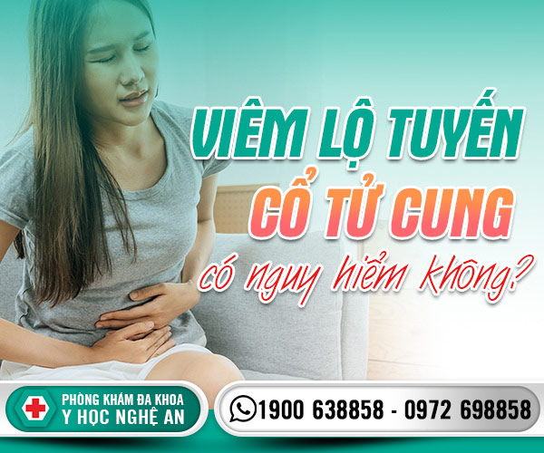 Viêm lộ tuyến cổ tử cung có nguy hiểm không