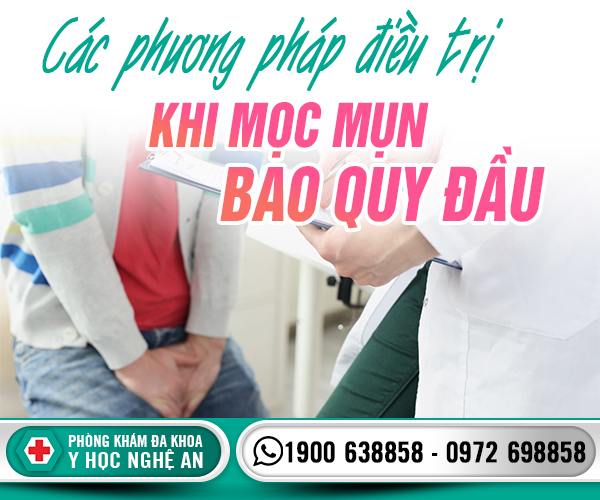 Các phương pháp điều trị khi mọc mụn bao quy đầu