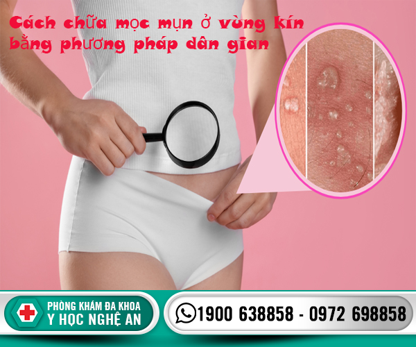 Chữa mọc mụn ở vùng kín bằng phương pháp dân gian