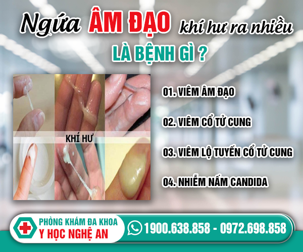 Ngứa vùng kín