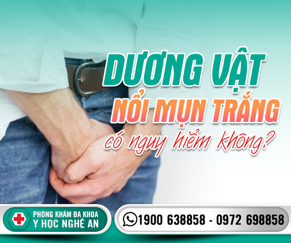 Dương vật nổi mụn trắng có nguy hiểm không